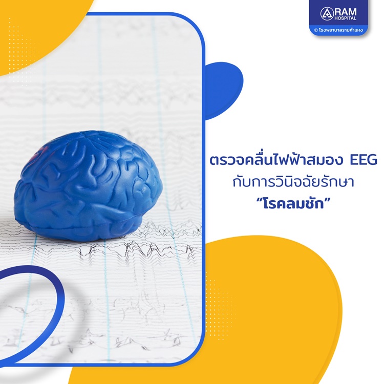 ตรวจคลื่นไฟฟ้าสมอง EEG กับการวินิจฉัยรักษา โรคลมชัก
