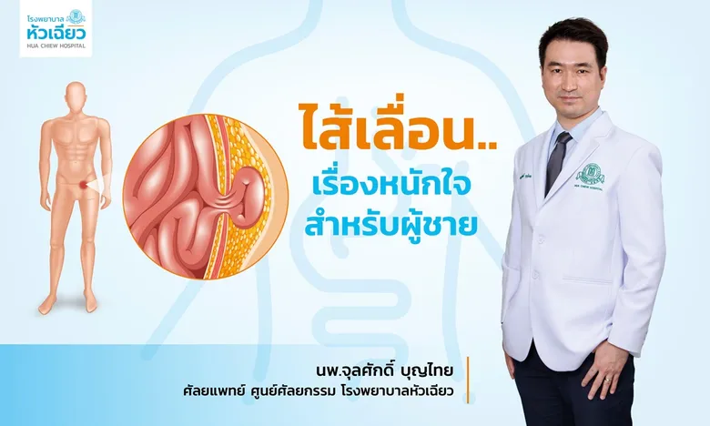 ไส้เลื่อน.. เรื่องหนักใจสำหรับผู้ชาย