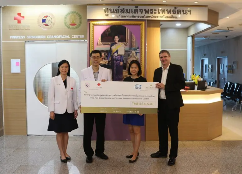กลุ่มโรงแรมอนันตรา มอบเงินบริจาคให้กับศูนย์สมเด็จพระเทพรัตนฯ แก้ไขความพิการบนใบหน้าและกะโหลกศีรษะ