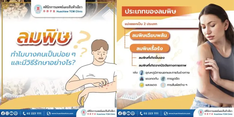 ลมพิษ ผื่นลม ผื่นซ่อนเร้น โรคผิวหนังเรื้อรังที่เป็นซ้ำแล้วซ้ำอีก โดย คลินิกการแพทย์แผนจีนหัวเฉียว
