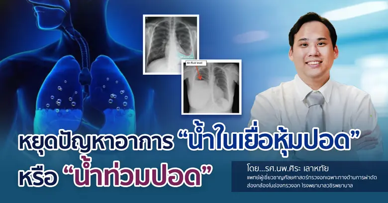 หยุดปัญหาอาการ "น้ำในเยื่อหุ้มปอด" หรือ "น้ำท่วมปอด"