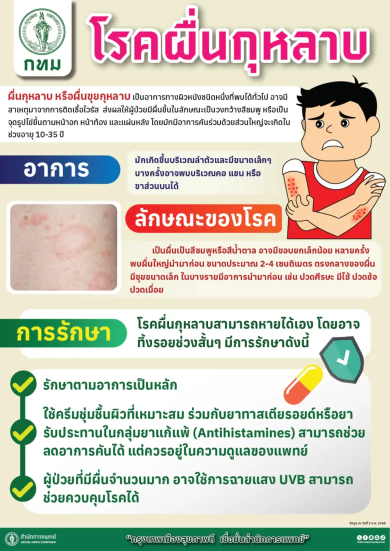 กทม. ชี้โรคผื่นกุหลาบไม่ใช่โรคติดต่อ เร่งส่งเสริมความรู้การป้องกัน-รักษาที่ถูกต้อง