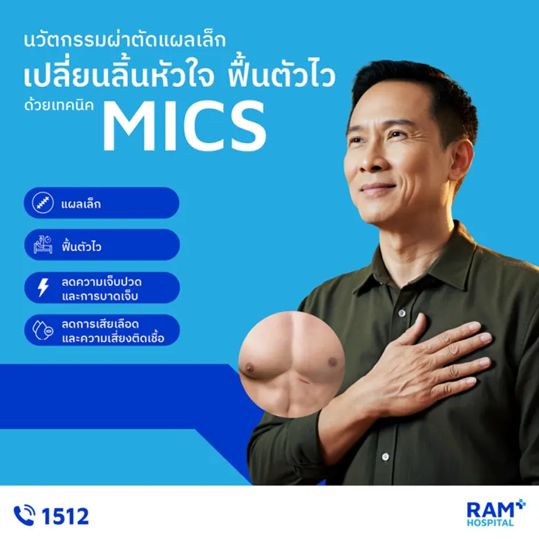 นวัตกรรมผ่าตัดแผลเล็ก เปลี่ยนลิ้นหัวใจ  ฟื้นตัวไว ด้วยเทคนิค MICS