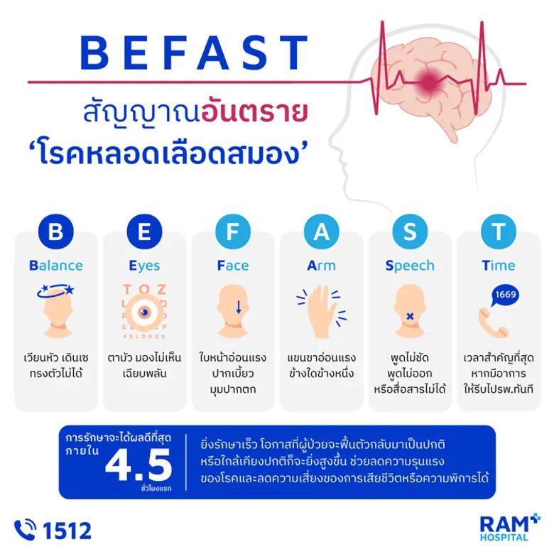 BEFAST สัญญาณอันตราย "โรคหลอดเลือดสมอง" BEFAST สัญญาณอันตราย "โรคหลอดเลือดสมอง"