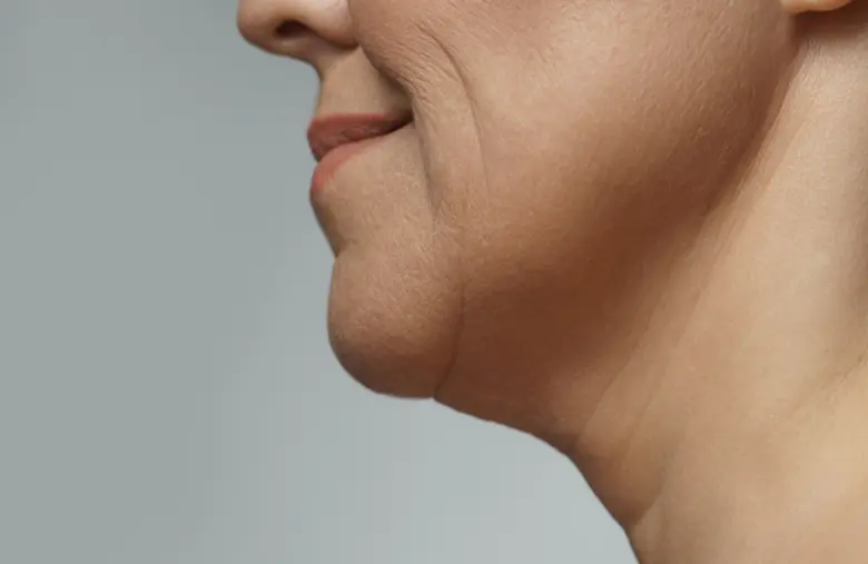 Program Oligio Vs Program OligioX ต่างกันอย่างไร