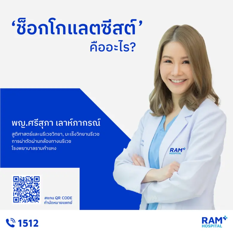 "ช็อกโกแลตซีสต์" คืออะไร?