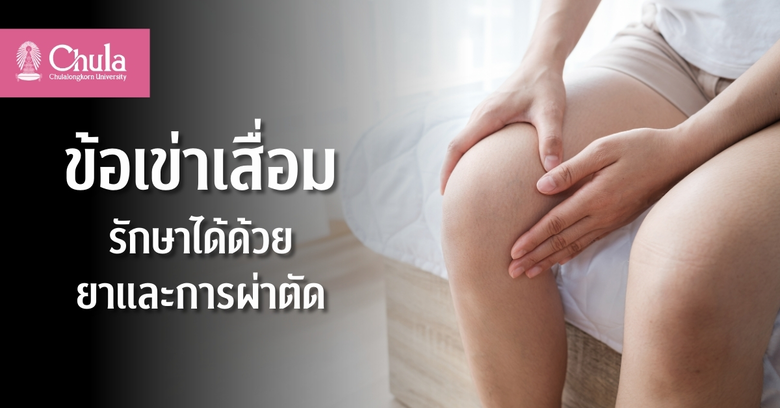 ข้อเข่าเสื่อม โรคฮิตในผู้สูงอายุ รักษาได้ด้วยยาและการผ่าตัด