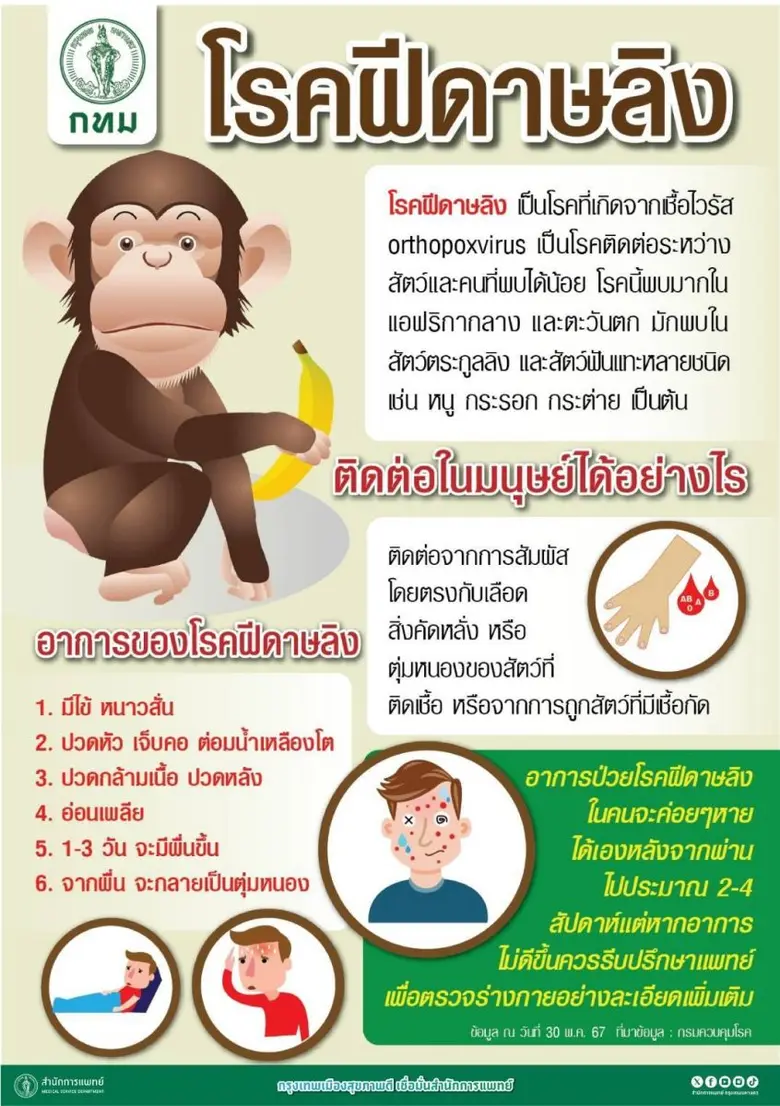 กทม. ติดตามเฝ้าระวังการแพร่ระบาดโรคฝีดาษวานรในกรุงเทพฯ อย่างใกล้ชิด