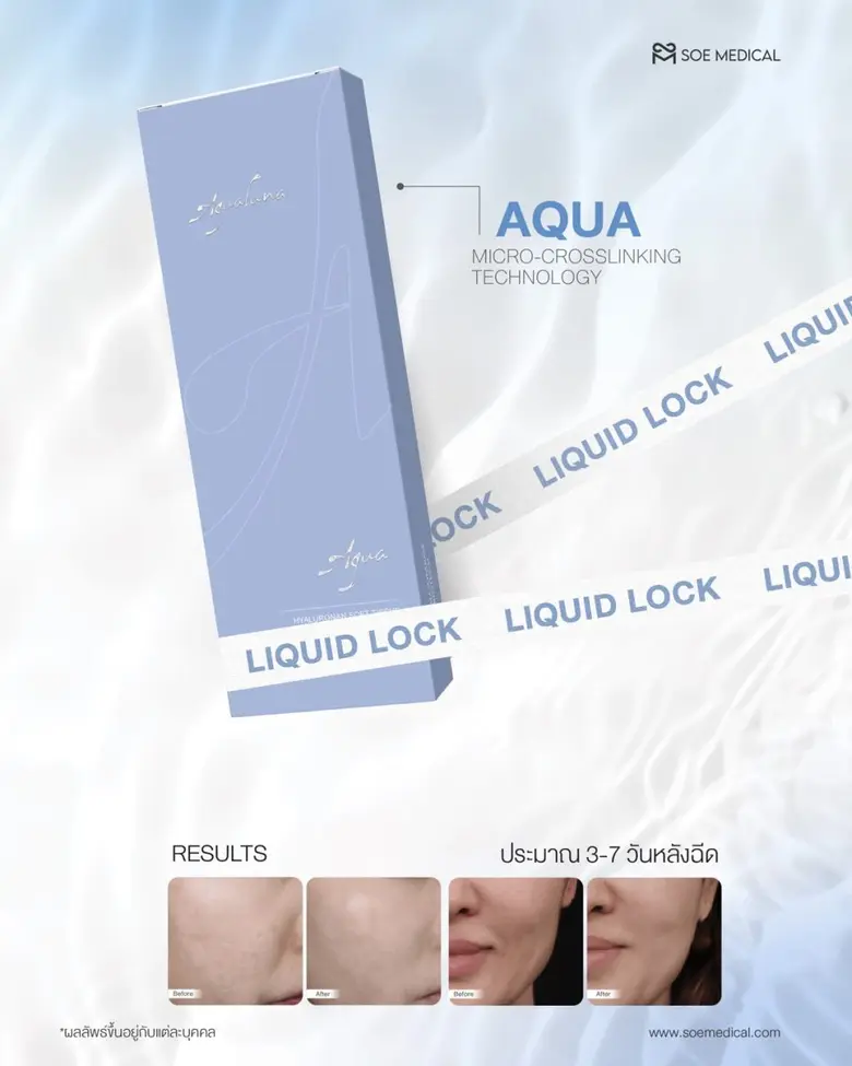 SOE Medical เปิดตัว "Aqualuna Liquid Lock" ครั้งแรกในไทย นวัตกรรมเจลงานผิวทางการแพทย์ Hyaluronic Acid ตอบโจทย์ผิวธรรมชาติ