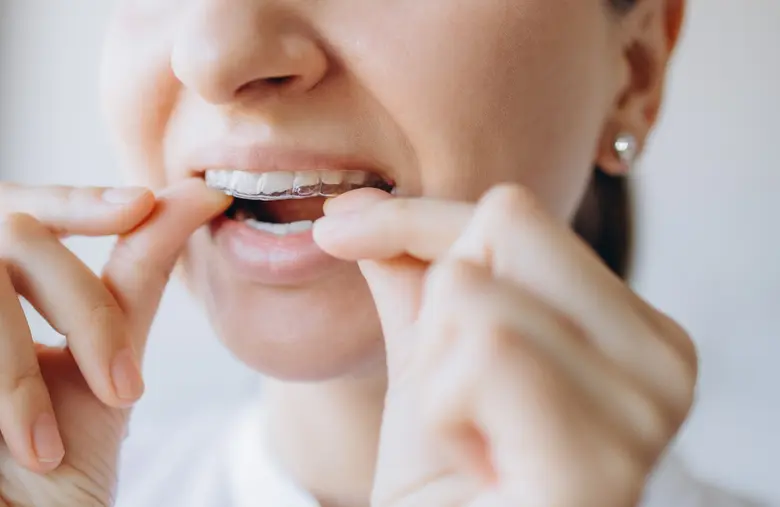 วัยทำงานสามารถจัดฟันได้ไหม ตอบชัดสำหรับคนวัย 30+