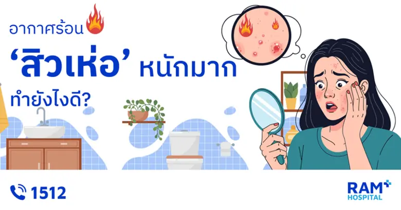 อากาศร้อน 'สิวเห่อ' หนักมาก ทำยังไงดี?