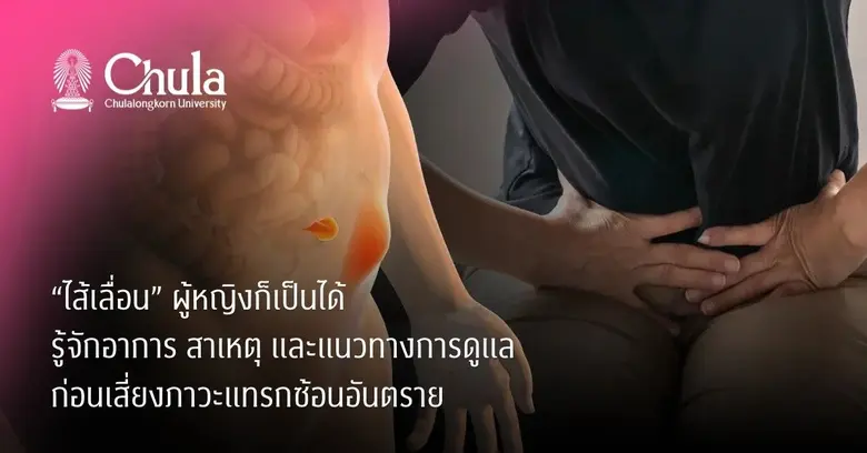 "ไส้เลื่อน" ผู้หญิงก็เป็นได้ รู้จักอาการ สาเหตุ และแนวทางการดูแล ก่อนเสี่ยงภาวะแทรกซ้อนอันตราย