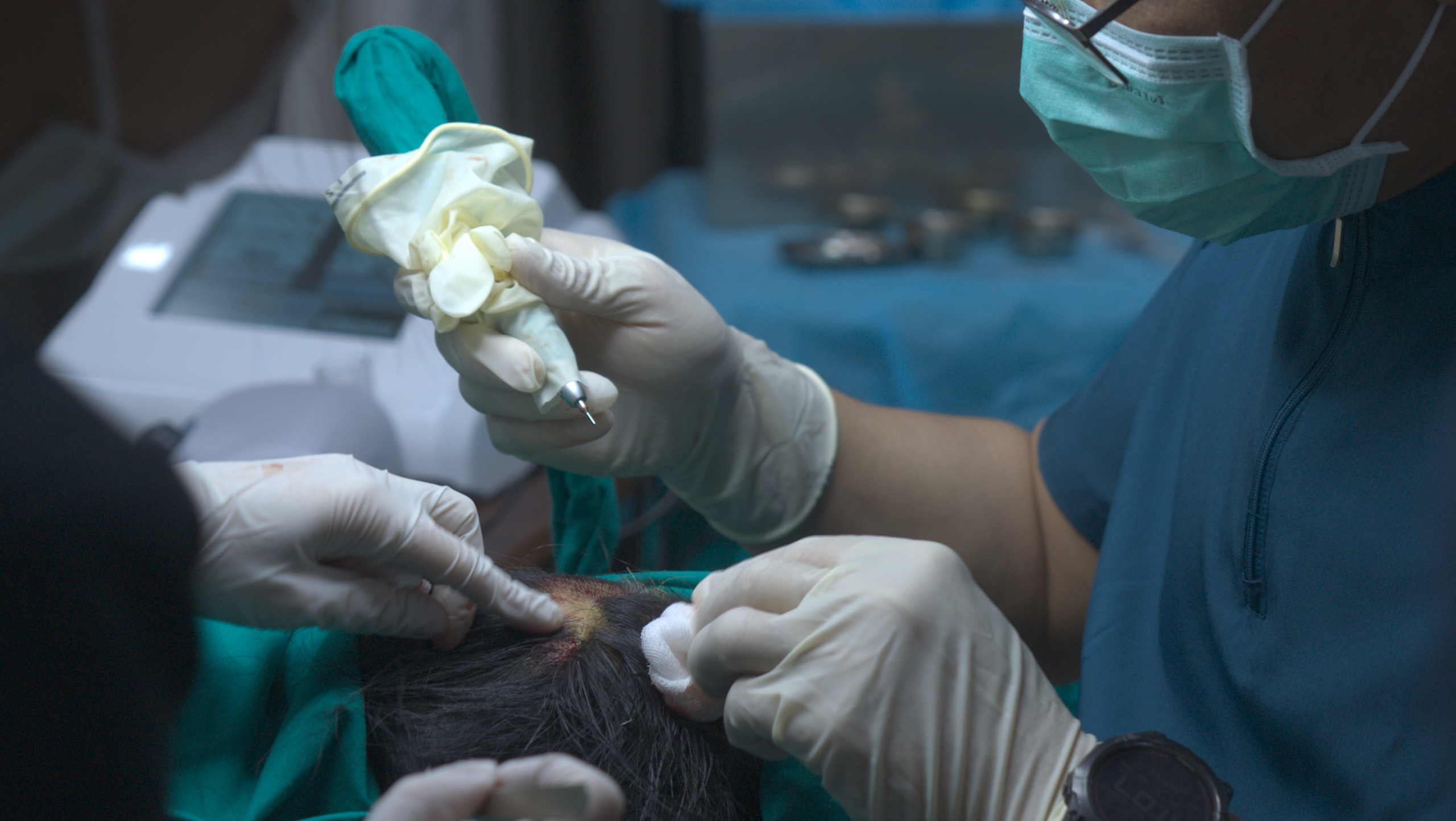 Vega Dermatology &amp; Wound Care Unit เปิดตัวแนวทางการฟื้นฟูเนื้อเยื่อขั้นสูงด้วย UC-MSC มุ่งรักษาบาดแผลซับซ้อนและแผลเรื้อรัง