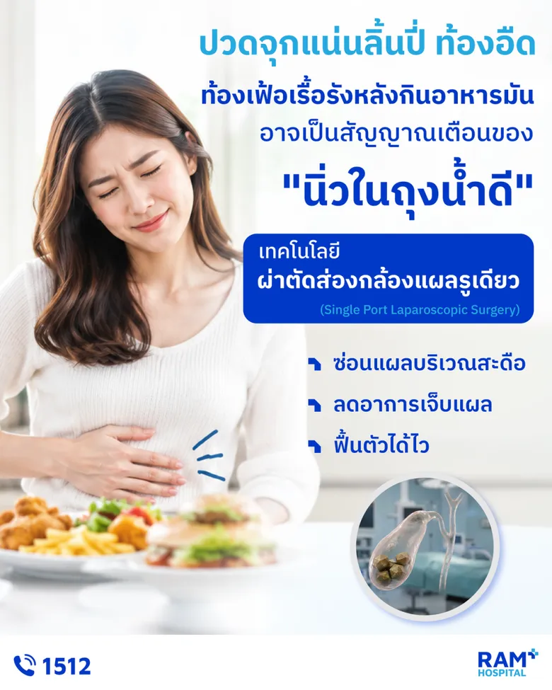 ปวดจุกแน่นลิ้นปี่ ท้องอืด ท้องเฟ้อเรื้อรังหลังกินอาหารมัน... อย่าคิดว่าเป็นแค่โรคกระเพาะ เพราะนั่นอาจเป็นสัญญาณเตือนของ "นิ่วในถุงน้ำดี"