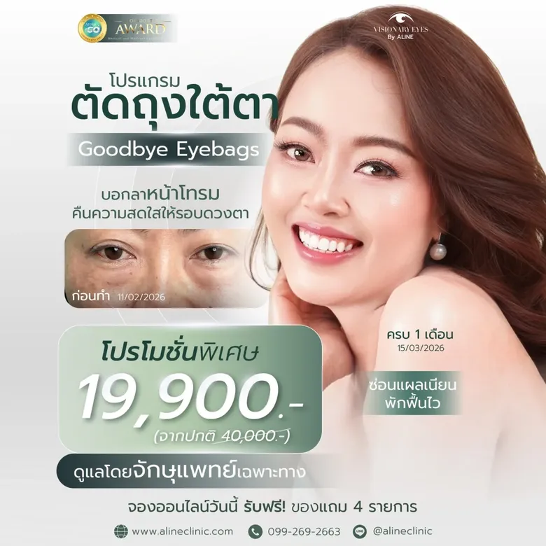 ผ่าตัดถุงใต้ตา ราคาเท่าไหร่? เช็กโปรโมชันล่าสุด พร้อมเทคนิคจัดเรียงไขมันที่ ALINE Clinic