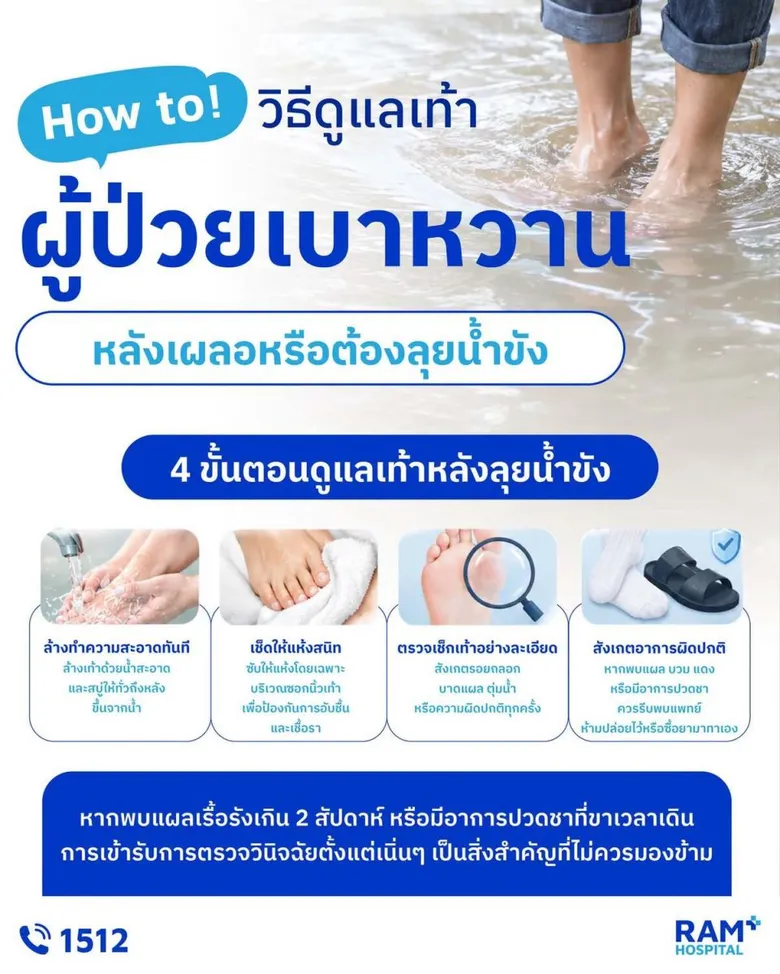 How to! วิธีดูแลเท้าผู้ป่วยเบาหวาน หลังเผลอหรือต้องลุยน้ำท่วม