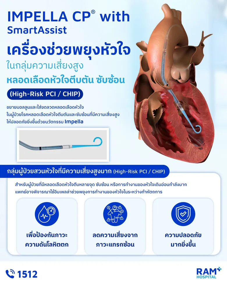 ขยายบอลลูนและใส่ขดลวดหลอดเลือดหัวใจในผู้ป่วยโรคหลอดเลือดหัวใจตีบตันและซับซ้อนที่มีความเสี่ยงสูง ให้ปลอดภัยยิ่งขึ้นด้วยนวัตกรรม Impella