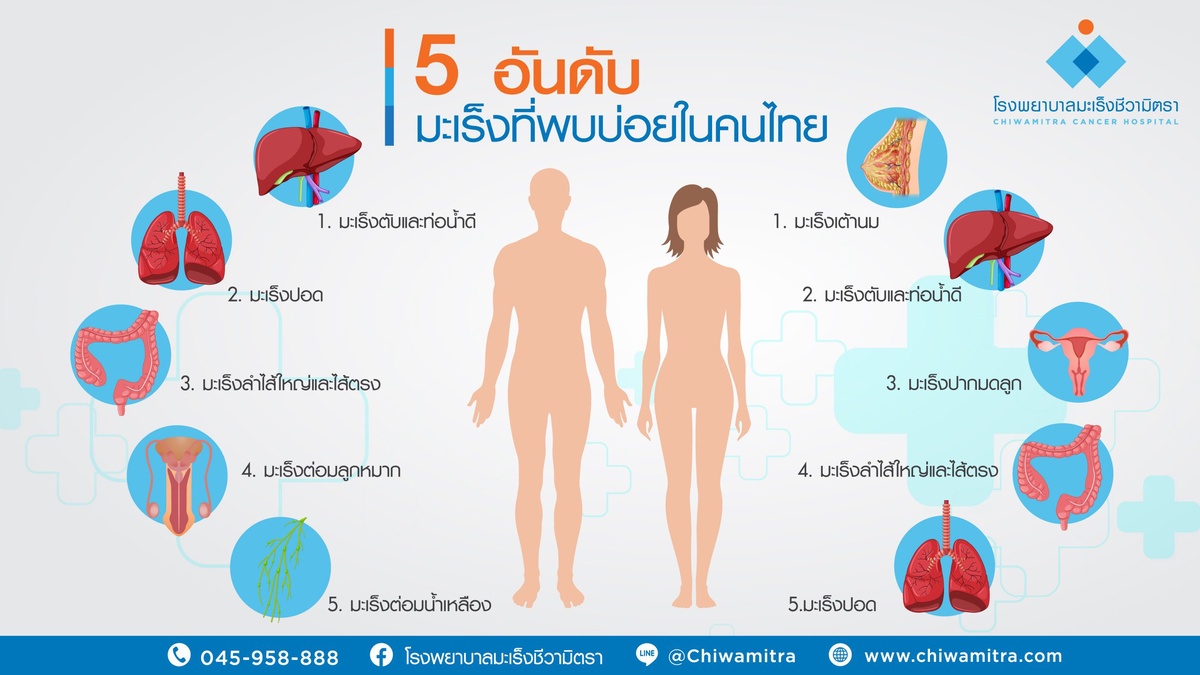 ส่องอันดับ 5 มะเร็งยอดฮิตในผู้ชายและผู้หญิงไทย