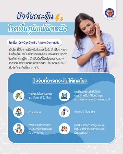 โรคผื่นภูมิแพ้ผิวหนัง โรคใกล้ตัวที่ถูกมองข้าม