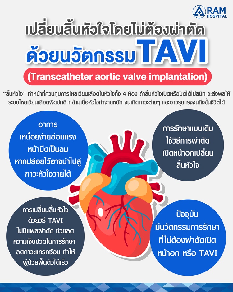 เปลี่ยนลิ้นหัวใจโดยไม่ต้องผ่าตัด ด้วยนวัตกรรม TAVI
