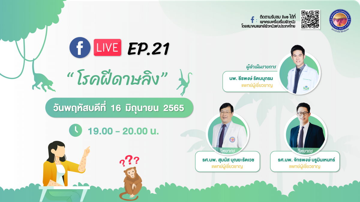 สมาคมแพทย์ผิวหนังฯ เชิญรับชมเพจเฟซบุ๊ก ครบเครื่องเรื่องผิวหนังEP.21 ตอน โรคฝีดาษลิง