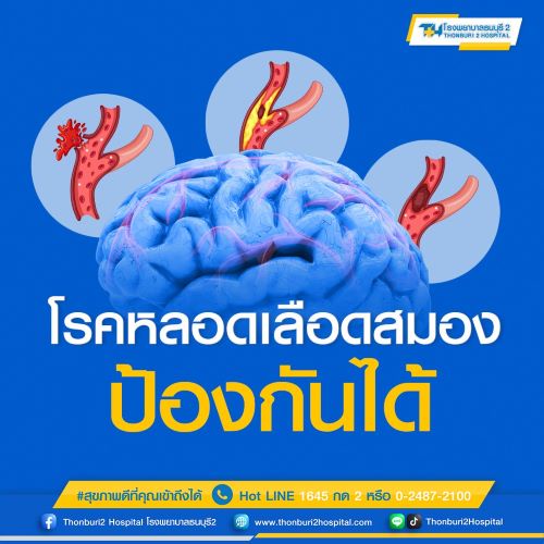 หลอดเลือดสมองป้องกันได้ พบกับโปรแกรมคัดกรองโรคหลอดเลือดสมองที่โรงพยาบาลธนบุรี2