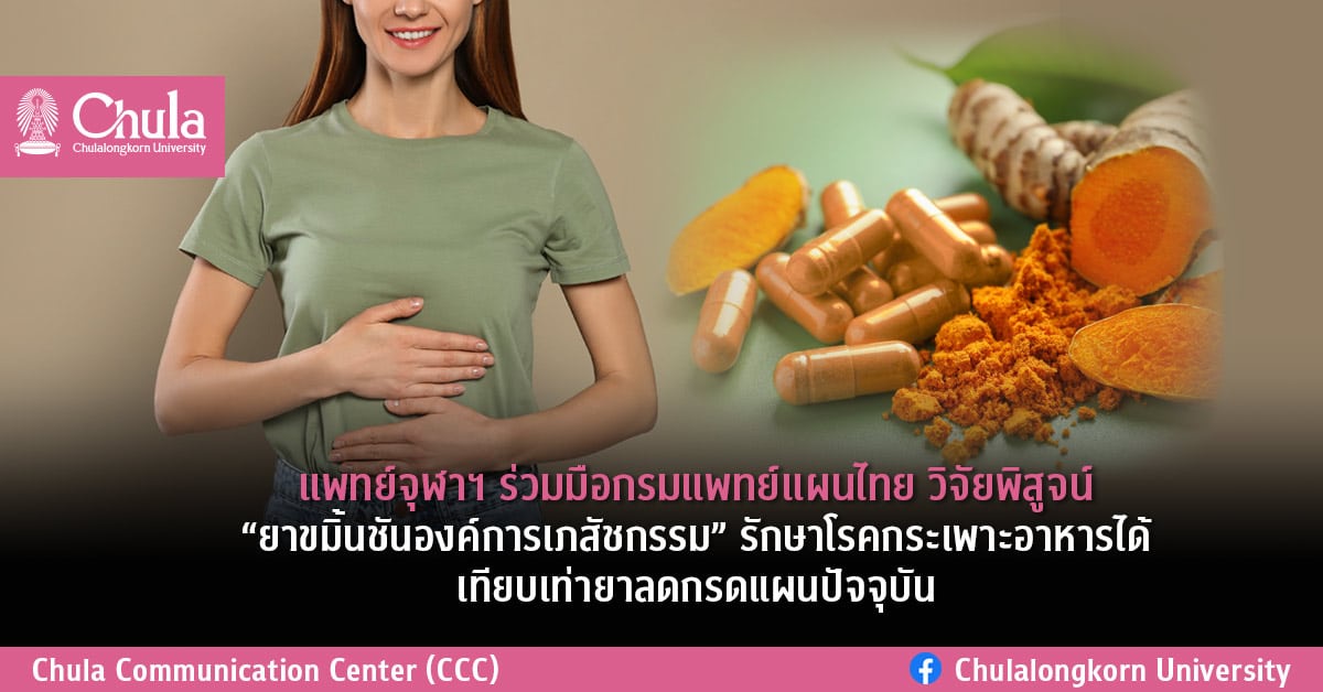 แพทย์จุฬาฯ ร่วมมือกรมแพทย์แผนไทย วิจัยพิสูจน์ยาขมิ้นชันองค์การเภสัชกรรม รักษาโรคกระเพาะอาหารได้เทียบเท่ายาลดกรดแผนปัจจุบัน
